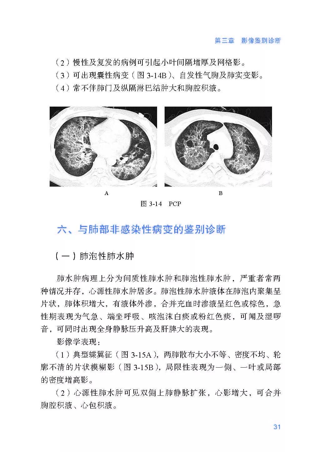 美国新冠肺炎超710万例(美国新冠肺炎超710万例了吗)