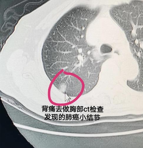 新冠肺炎的最新动态/新冠肺炎最新动向