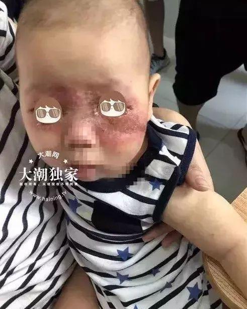 多地发现病例浙江已有人感染(多地发现病例浙江已有人感染艾滋病病毒)